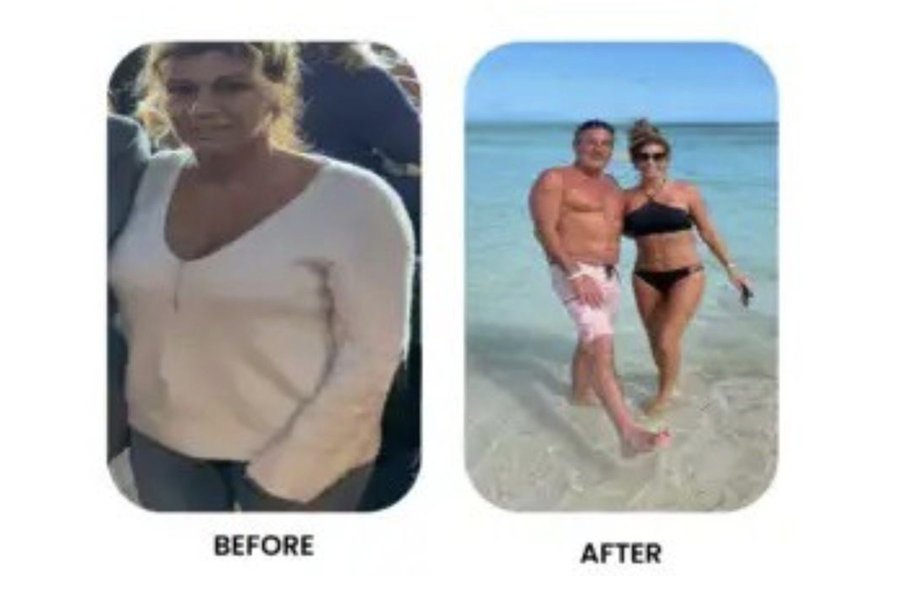 Before and after patient story 1