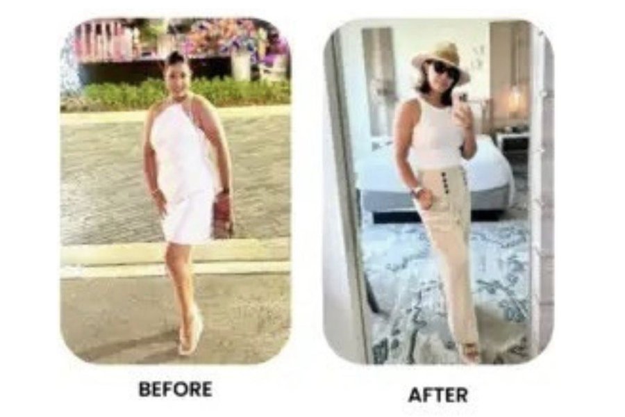 Before and after patient story 2