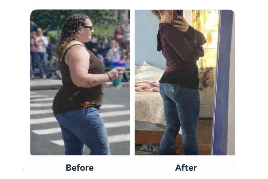 Before and after patient story 3