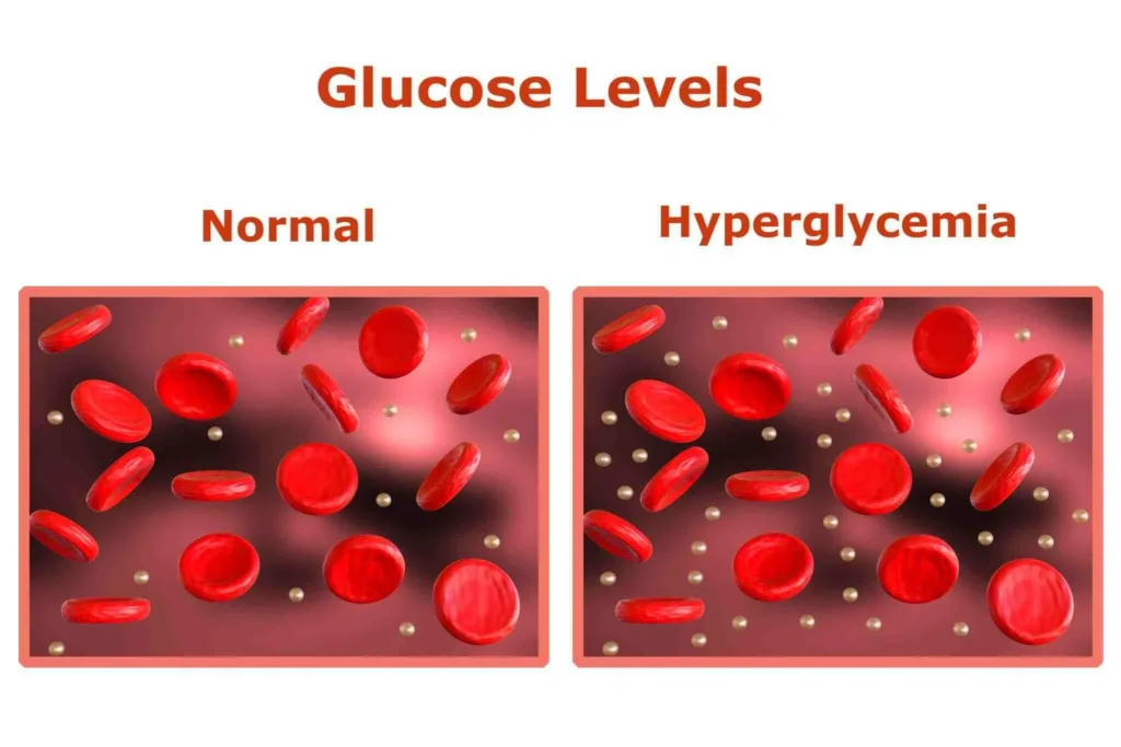 Medical diagram comparing normal blood glucose levels versus hyperglycemia in diabetes patients treated at Everest clinic Connecticut