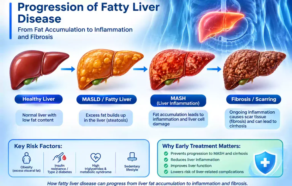 Everest eClinic anatomical illustration showing the progression from a healthy liver to MASLD fatty liver, MASH liver inflammation, and liver fibrosis